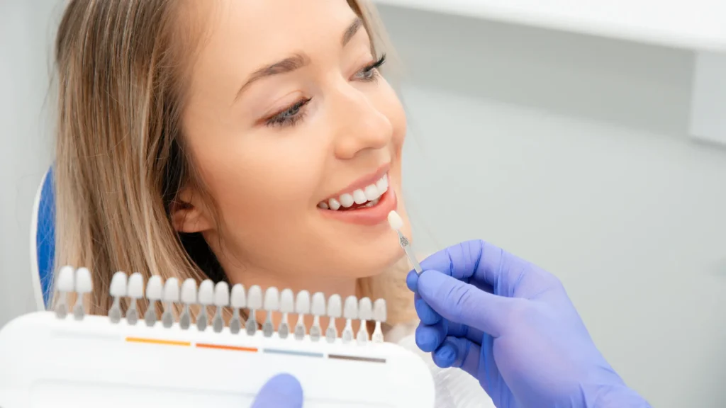 Dental Bonding vs Veneers