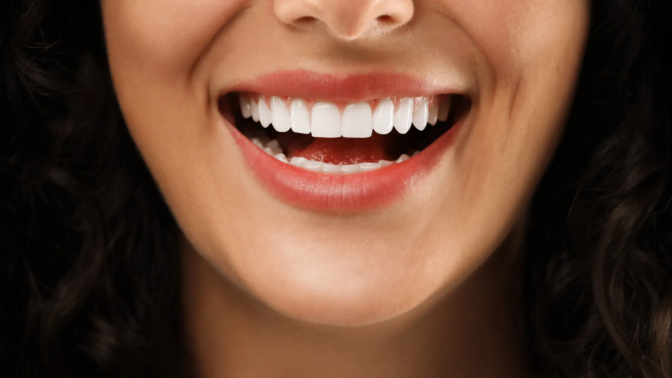 Smile Makeover in Rexburg